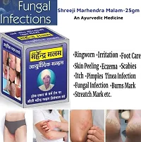 Shreeji Marhendra Itching Malam For Fungal Infection, Skin Treatment, Eczema, Ringworm 25 G-thumb2