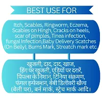 Shreeji Marhendra Ayurvedic Malam For Anti Dad Khaj Khujali  Skin fungal Infection, itching Cream , Skin Tretment, Ringworm, Eczema, Burn Mark, Foot Crack Care Ointment 25 G-thumb3