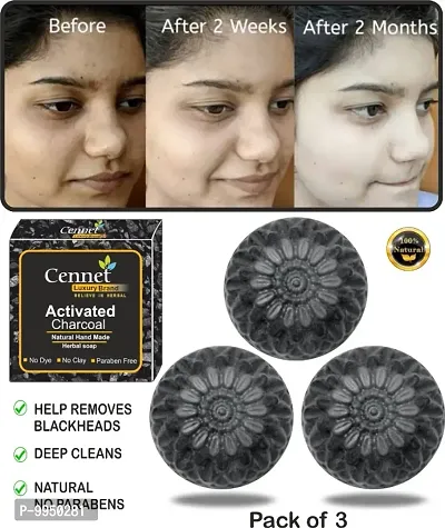 Buy Cennet Activated Charcoal Soap for Men women Skin Whitening