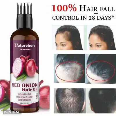 Red Onion and Ginger Hair Growth and Hair Fall Control Oil 100 ml-thumb0