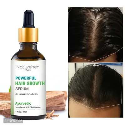 Powerful Hair Growth Serum With Chandan And Olive Booster (30ml)