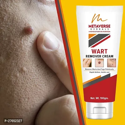 Men  Women Wart Removal Cream Facial Skin Care Wart Remover Ointment