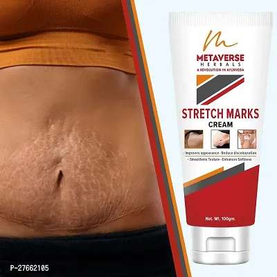 FutureGlow Virtual World Stretch Mark Minimizer, 100g-thumb0