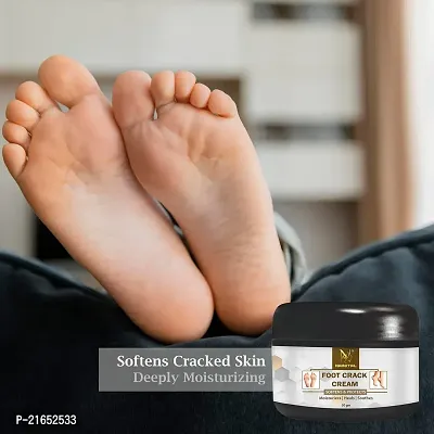 Nainital | Foot Cream For Rough, Dry and Cracked Heel, Feet Cream For Heel Repair Pack of 3-thumb5