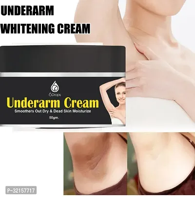 Classic Underarm And Neck Back Whitening Cream-thumb4