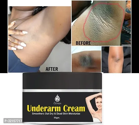 Classic Underarm And Neck Back Whitening Cream-thumb5