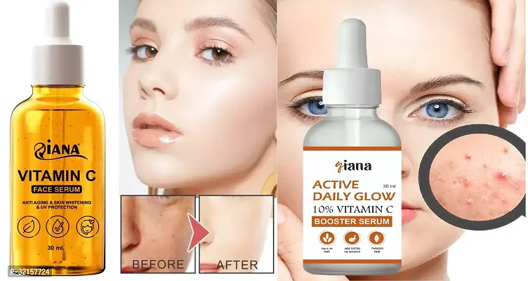 Classic Lightweight Vitamin C Serum For Instant Radiance Quick Absorption With Vitamin C Face Serum For Dark Spots Pack Of 2-thumb0