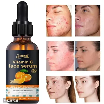 Classic Vitamin C Face Serum For Brightening And AntiAging-thumb4