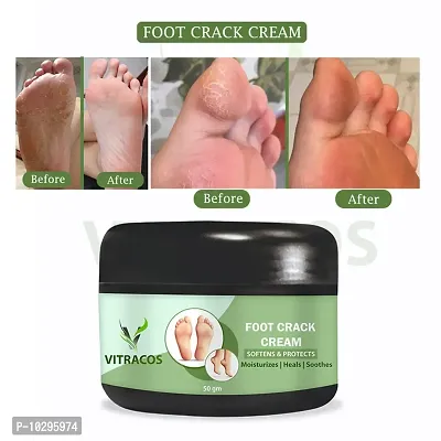 Foot Cream Looking Nutri Height Capsules Darar For Cracked Heels Antiseptic Cream