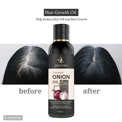 Onion and Bhringraj Hair Growth Oil with Curry Leaf and Amla Oils | ONION HAIR OIL (50ML) (PACK OF 1)-thumb0