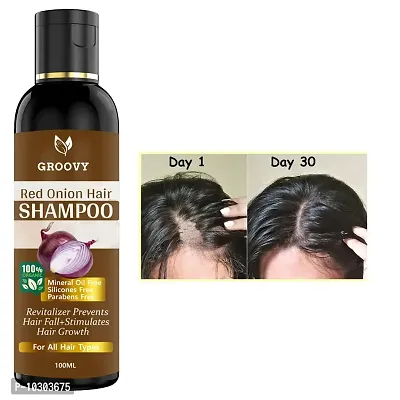 Red Onion Shampoo For Hair Regrowth Bio Active Hair Oil Nourishing Hair Treatment With Real Onion Extract Intensive Hair Fall Dandruff Treatment Hair Shampoo 100 Ml-thumb0