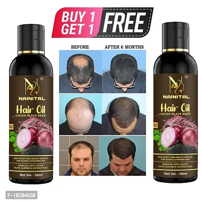 Onion With Black Seed Oil For Controls Hair Fall Hair Oil 50Ml For Man And Women Buy 1 Get 1 Free
