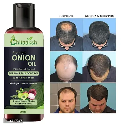 Onion with black seed Oil for Controls Hair Fall Hair Oil 50ml (pack of 1) for man and woman.