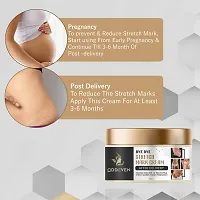 Oddeven Stretch Cream For Stretch Marks Removal Post Pregnancy Fast Work Result Stretch Mark Cream Oil 100 G,Pack Of 2-thumb2