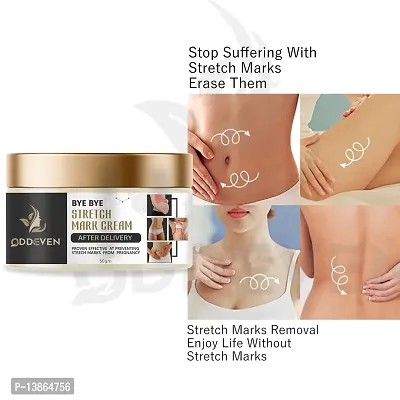 Stretch Marks Cream After Delivery 100% Result