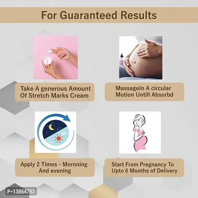 Stretch Marks Scar Removal Cream Cream During After Pregnancy Delivery Women Organic Bio Cream For To Remove Hyperpigmentation,Anti Cellulite-thumb2