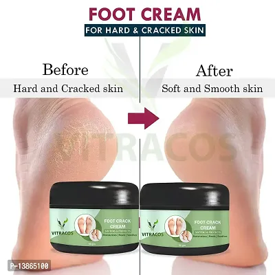 Foot Cream | Soothes | Softens | Protects Feet | (50Gm With 50Gm) (Pack Of 2)-thumb0