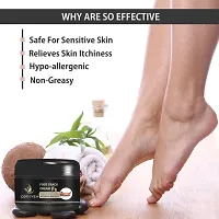 Foot Care Cream For Rough, Dry And Cracked Heel (50Gm) For Woman.-thumb3