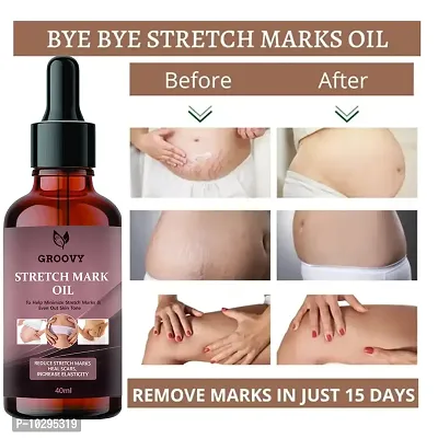 Stretch Marks Oil Natural Origin Stretch Marks Removal Oil 40Ml-thumb0