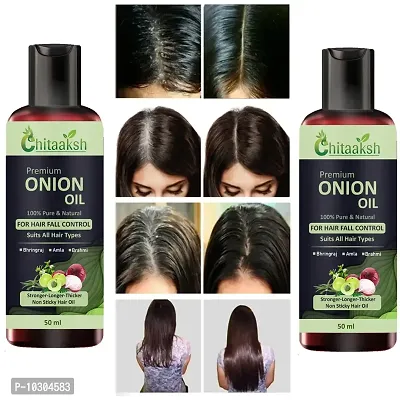 Onion Hair Fall Control Herbal Hair Oil -50Ml - Treats Rough And Damaged Hair, Reduces Hair Loss - Paraben, Sulphate Free50Ml, Pack Of 2-thumb0