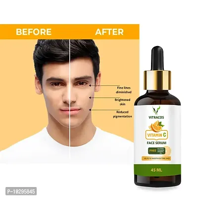 Vitracos Skin Correct Face Serum With Niacinamide And Ginger Extract For Acne Marks And Scars - 45 Ml