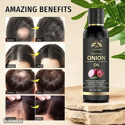 Onion Oil For Hair Regrowth And Hair Fall Control Hair Oil - 50Ml