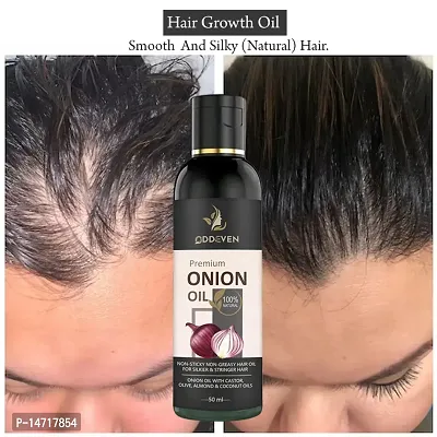 Onion Natural Hair Oil  ONION HAIR OIL (50ML) (PACK OF 1)-thumb0