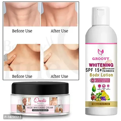 Skin Brightening Cream For Face Body Whitening Creamdark Spot Remover 100Gm With Whitening Cream-thumb0