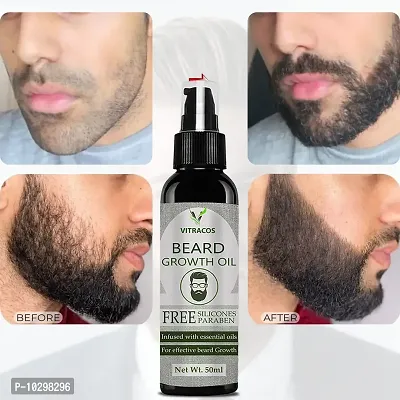 Vitracos Beard Growth Oil For Men For Better Beard Growth With Thicker Beard- 50 ml