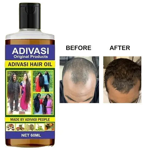 Herbal Hair Growth Oil