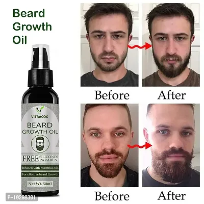 Vitracos Beard Growth Oil ( Hair Oil- 50 ml