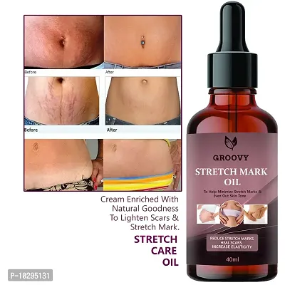 Stretch Mark Oil With The Goodness Of Seabuckthorn Oil, Vitamin E And C, Lavender All Skin Types For Scars And Stretch Marks-40Ml-thumb0