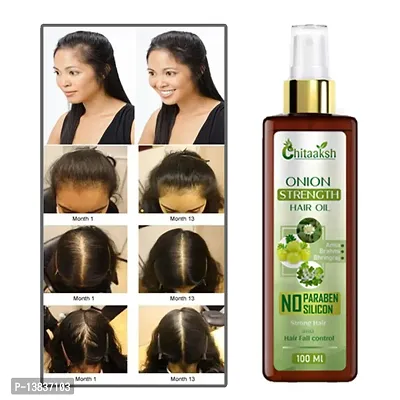 Chitaaksh Onion Hair Oil With The Goodness Of Ginger And Flaxseed 100% Pure And Natural An Ayurvedic Blend For Faster Hair Growth All Hair Types Hair Oilnbsp;nbsp;(100 Ml)-thumb0