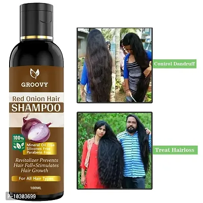 Onion Black Seed - Hair Care Growth And Shine Tea Tree Oil Omega- 3 Vitamin-E Hair Shampoo- 100 Ml