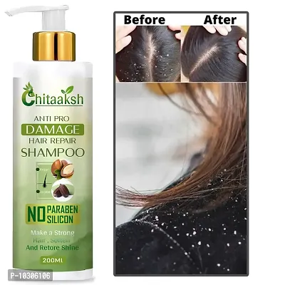 Hair Fall Shampoo For Hair Growth And Hair Fall Control, 200Ml