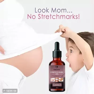 Stretch Marks Oil Stretch Marks Scar Removal Cream Oil In During After Remover Scars- 40 Ml-thumb3