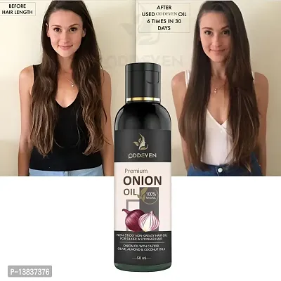 Red Onion (Pyaaz) Oil For Hair Regrowth And Hair Fall Control Onion Hair Oil (50Ml) (Pack Of 1)