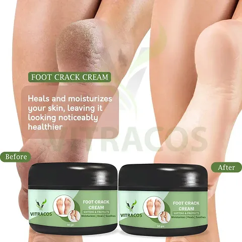 Best Foot care Foot Crack Cream