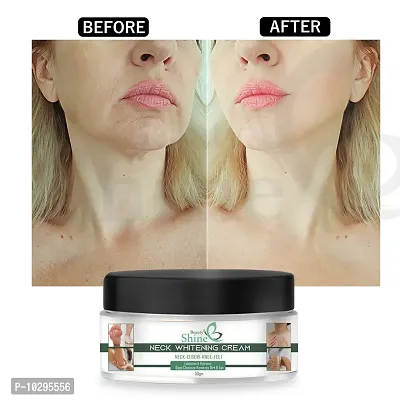 Dark Under Arm Cream For Whitening Dark Spot Removal Body Creams Armpit Whitening Cream Formula - 50 Gm-thumb0