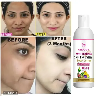 Skin Whitening Lotion Cream Look As Young As U Feel -Acne Care Face Cream With Whitening Cream-thumb3