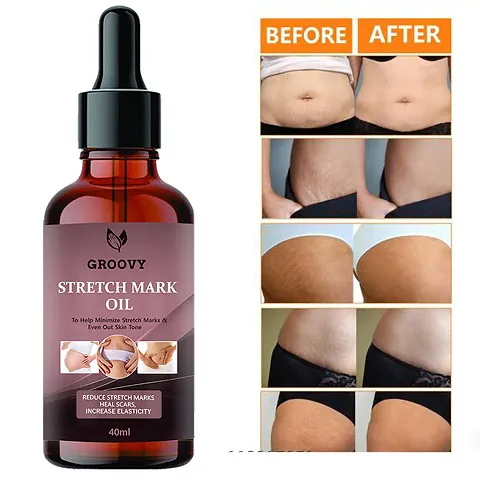 Groovy Stretch Mark Oil