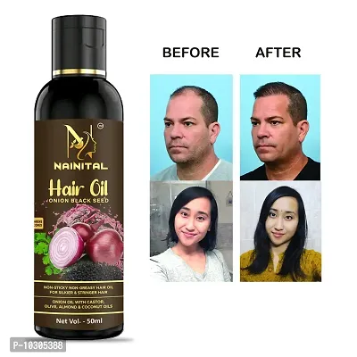 Hair Oil Help For Rapid Hair Growth,Anti Hair Fall,Split Hair And Promotes , For Man And Women-thumb0