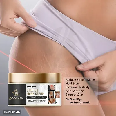 New Stretch Mark Cream 50G (Pack Of 1)