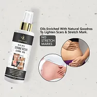 Stretch Marks Scar Removal Oil In During After Pregnancy Delivery Women,Organic Bio Oil,Anti Cellulite,Remover Scars (100Ml)-thumb3