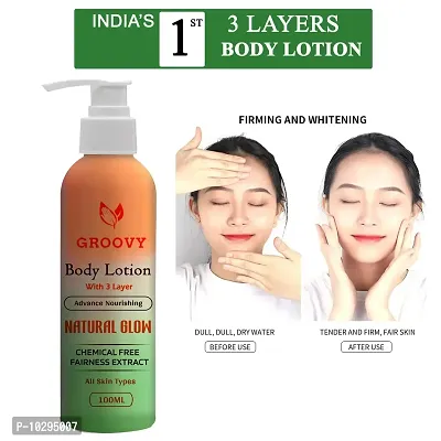 Skin Brightening Lotion For Face Dark Spot Remover - 100 Ml