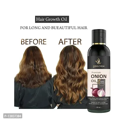 Ayurvedic Anti Hairfall|Hair Growth Oil|21 Natural Ingredientsnbsp; Onion Hair Oil (50Ml) (Pack Of 1)