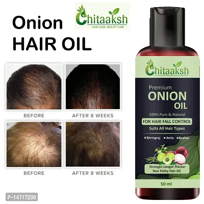 hair Oil Onion Hair Oil For Hair Growth Hair oilnbsp;(50 ml) For man and woman.