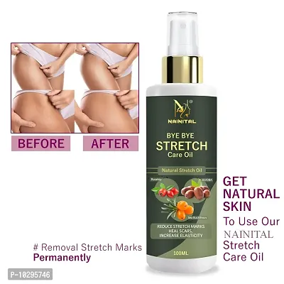 Nainital After Delivery Stretch Mark Removal Oil Organic Oil 100Ml-thumb0