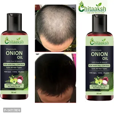 Red Onion Oil Help For Rapid Hair Growth,Anti Hair Fall,Split Hair And Promotes Softer  shinier Hair 50ml, PACK OF 2