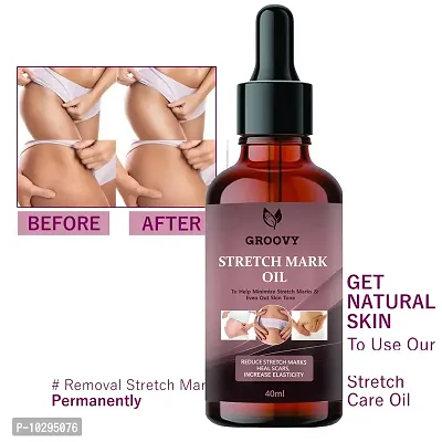 After Delivery Stretch Mark Removal Oil Organic Oil 40Ml